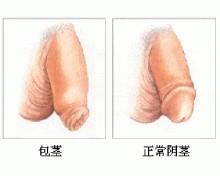 092142abbnc8u8qq4q1wm4.jpg