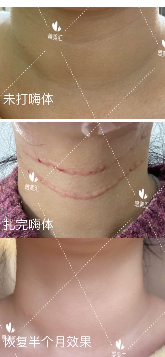 徱
